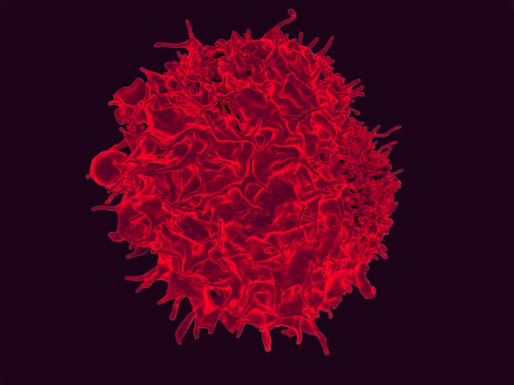 Clinical Evidence Supports Moving CAR-T Therapies Toward Earlier Treatment in Multiple Myeloma